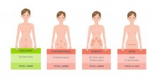 INCISION COMPARISON CHART