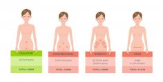 Robotic Surgery hysterectomy